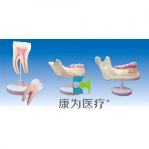 “康為醫(yī)療”磨牙、乳牙、橫牙解剖(自然大)