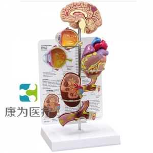 “康為醫(yī)療”醫(yī)患關(guān)系溝通模型-微型腦、眼、心、腎及動脈模型 （醫(yī)學(xué)指導(dǎo)模型）