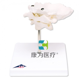 帶有枕骨片的環(huán)椎和樞椎組合，置于可拆卸基架