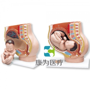 妊娠骨盆模型，3部分