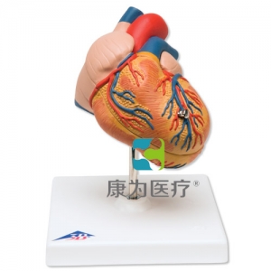 經(jīng)典心臟模型，呈左心室肥大，2部分