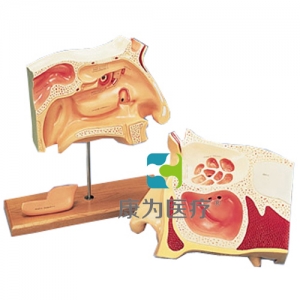 鼻竇內(nèi)窺鏡使用訓(xùn)練模型，2部分-德文注釋